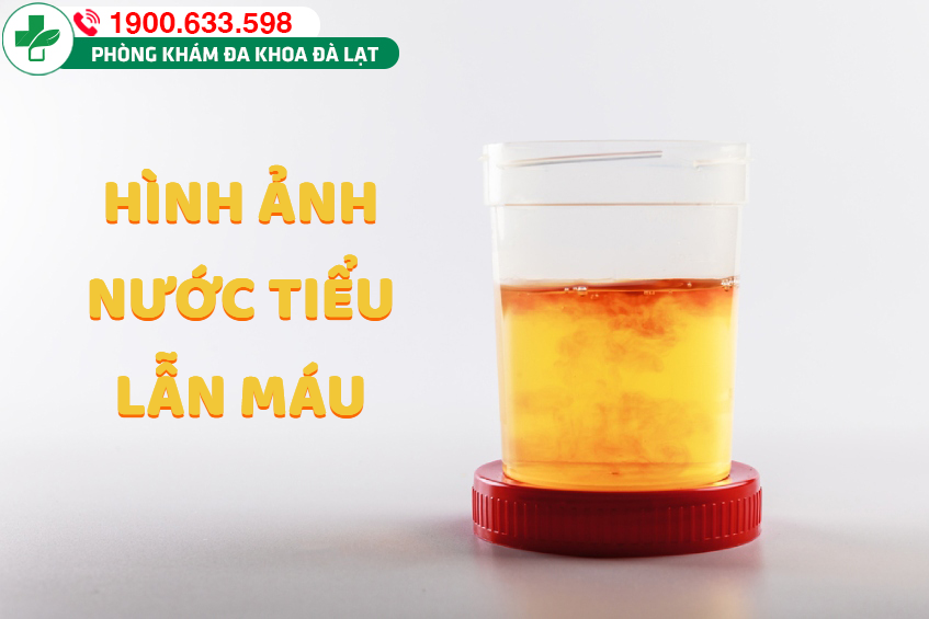 Hình ảnh minh họa